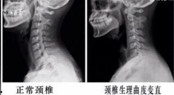 颈椎运动视频教程,轻松缓解颈肩不适，掌握正确运动方法