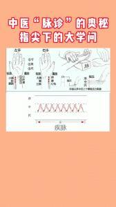 中医脉诊视频,视频教学带你掌握脉象奥秘